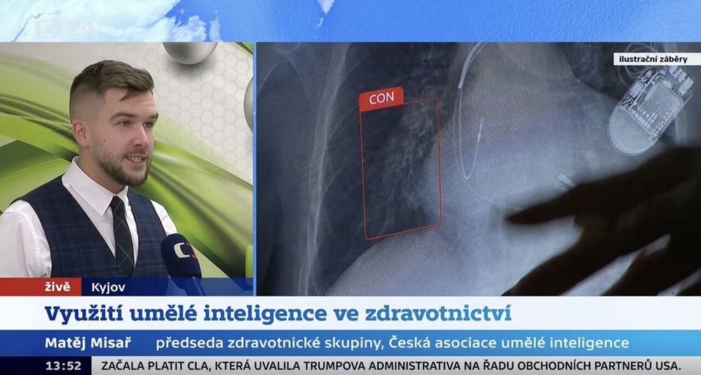 Živý vstup v ČT24